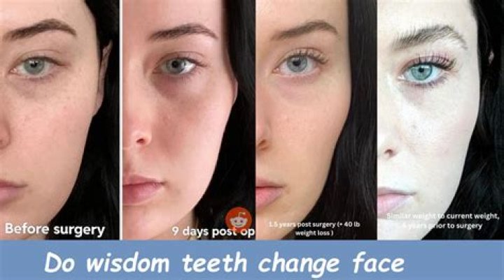 Cynthia Nixon’s Teeth: Before And After!